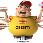 Hazards of Obesity and Ways to Manage Weight